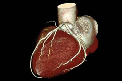 inside cardiac